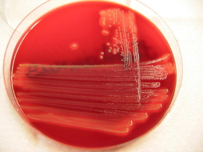 Kolonien von Staphylococcus aureus auf einer Blutagarplatte - © Dr. med. vet. Friederike Reinecke