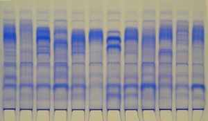 Untersuchung der Sorte von Kartoffeln und Getreide mittels Elektropherogramm