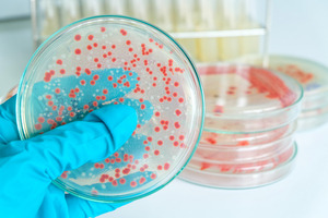 Bakterienwachstum auf festem Nährboden - © Tinydevil / shutterstock.com