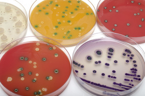Nachweis von pathogenen Keimen - © villorejo / Adobe Stock